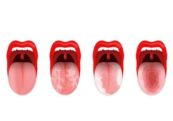 How to get rid of scars and indurations on the tongue