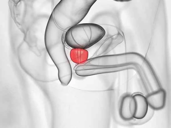 Does scrotal inflammation cause pain in the scrotum?