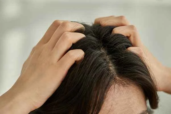 What's the best way to quickly remove dandruff?