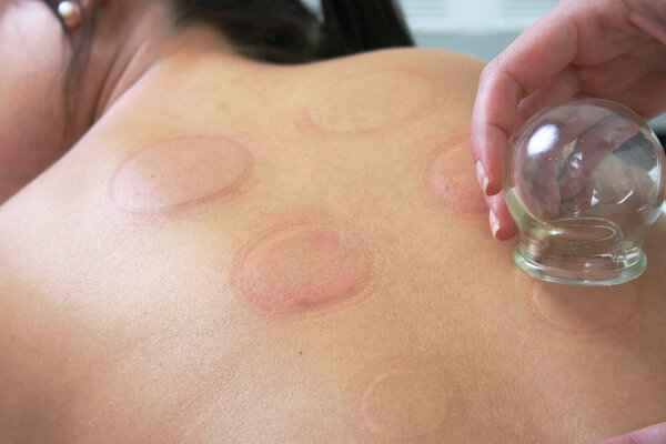 How to treat acute urticaria?