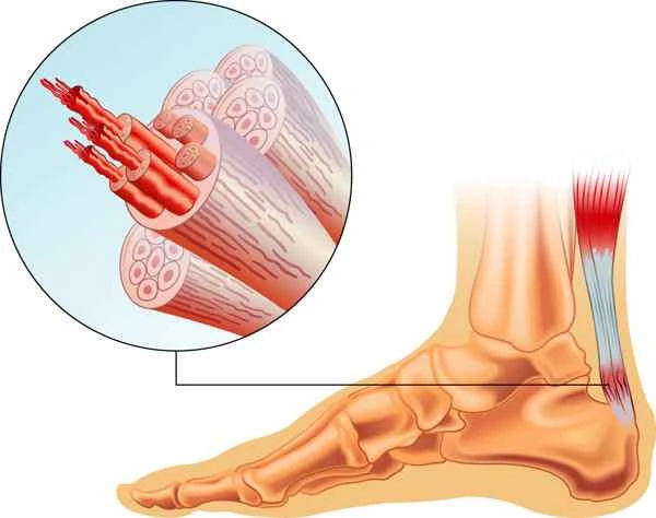 What causes the capillaries on the feet to turn purple?