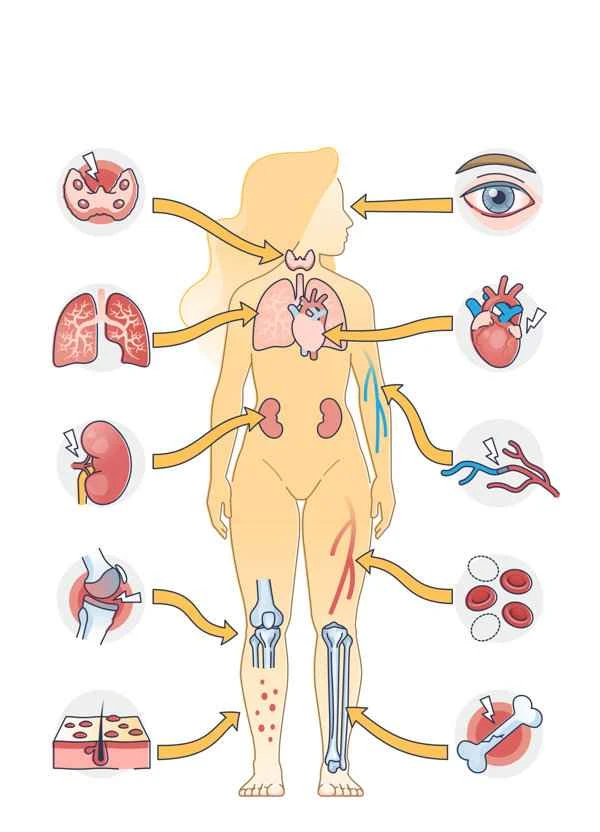 What disease causes symmetrical rashes on both lower limbs?