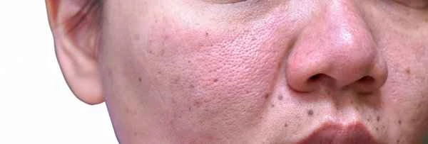 What can treat itchy scalp and dandruff?