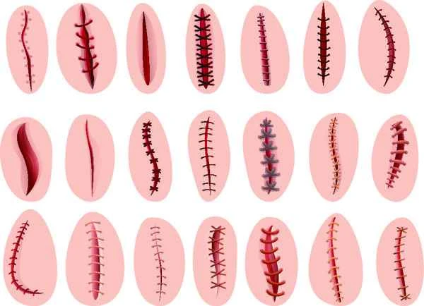 Is it okay if a frozen fish bone bleeds?