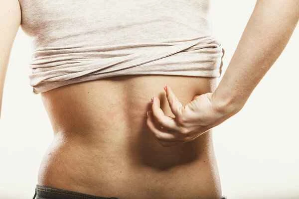 What could be causing my itchy red bumps all over my body?