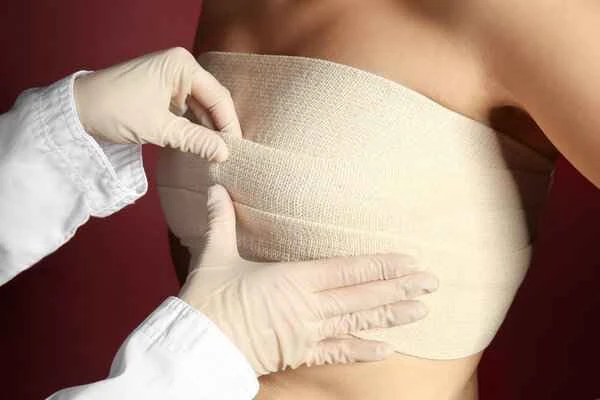 How to treat hypertrophic scars after surgery