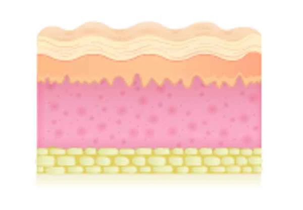 How to get rid of red keloid scars?