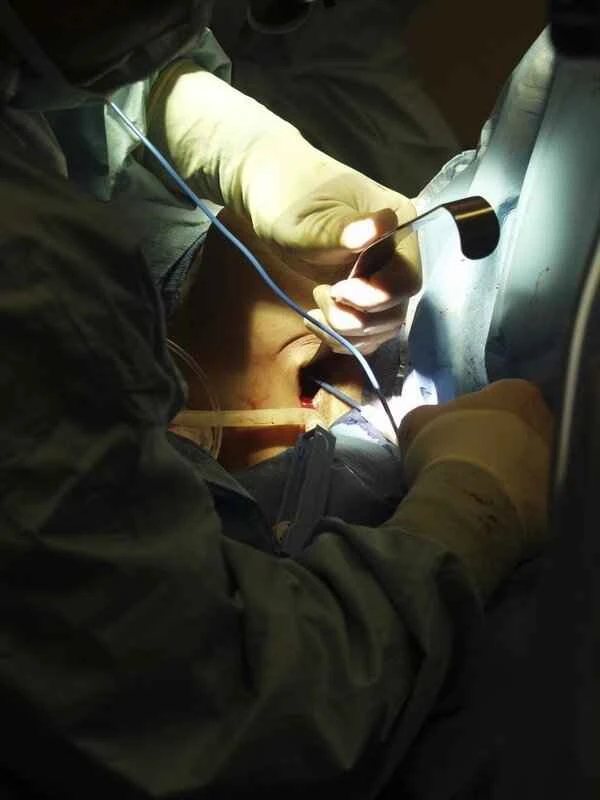 How to use medication to stop bleeding from scars?