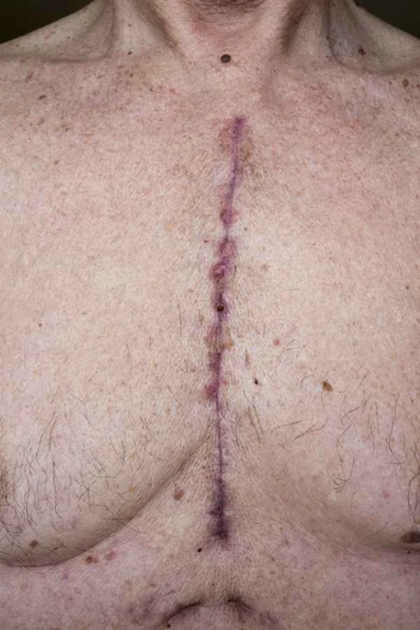 What exactly is a scar?
