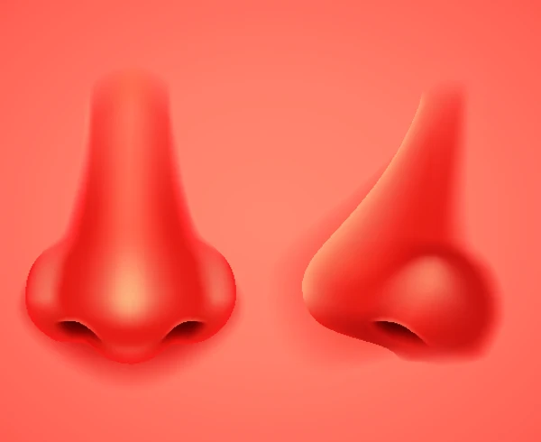 Botox injections cause bulges on both sides of the nose.