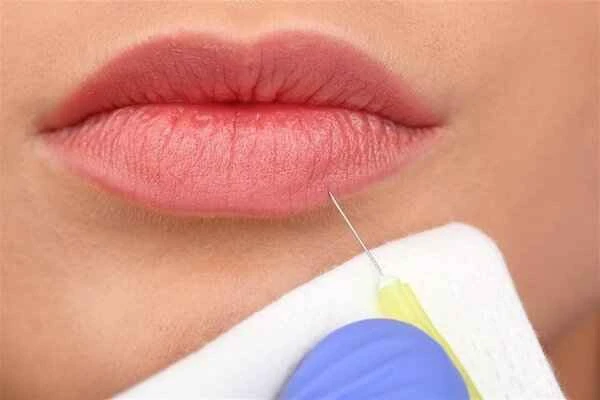 How to treat scars from thick lips becoming thinner