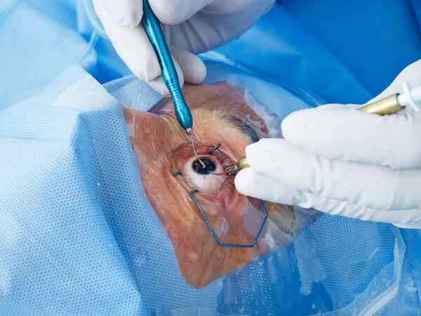 How long after surgery can I use scar cream?